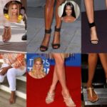 Celebrities who do not hide their bunions